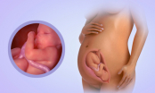Sự phát triển của thai nhi tuần thứ 31