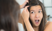 Top 10 thực phẩm ngăn ngừa tóc bạc sớm hiệu quả