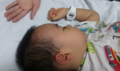 Vụ bé trai 20 tháng tuổi ăn... bạt tai vì nôn trớ: Cơ quan chức năng vào cuộc điều tra