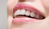 Cách làm trắng răng bằng dầu ô liu: Tại sao không thử, điều kỳ diệu sẽ xảy ra đấy?