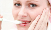 Nếu bị chảy máu chân răng là bạn đang đối mặt với căn bệnh hết sức nguy hiểm này