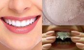 Mẹo đơn giản tẩy trắng răng hiệu quả ngay tại nhà ai thử cũng thành công
