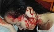 Vụ thiếu nữ bị hành hung trên taxi ở Hà Tĩnh: Đình chỉ công tác cô giáo chủ mưu