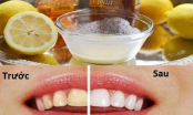 Phương pháp tự nhiên xử lý hàm răng xỉn màu thành trắng sáng trong vài phút