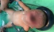 Xót xa: Bé trai tử vong vì bị cha ném ly trúng đầu