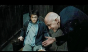 Diễn viên 'Harry Potter' bị gãy cổ, nghẽn phổi vì tai nạn kinh hoàng