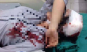 Vụ nữ sinh bị đánh gãy tay, ngất xỉu ngay tại cổng trường: Lời trần tình kinh hãi của nạn nhân