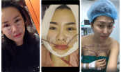 Phát hoảng với gương mặt kì dị của mỹ nhân Việt khi mới 'đập mặt xây lại'