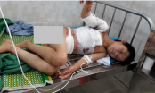 Hoàn cảnh đáng thương của bé trai 10 tuổi bị bỏng nặng vì điện giật