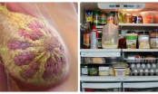 Đây chính là loại thực phẩm gây ung thư vú hầu hết đều có mặt trong tủ lạnh mọi nhà