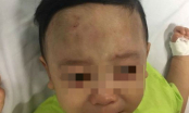 Vụ bé trai 1 tuổi bị bạo hành nghiêm trọng: Công an giăng lưới 5 đối tượng tại bệnh viện