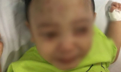 Vụ bé trai 1 tuổi bị bạo hành nghiêm trọng: Làm rõ nhân thân người mẹ