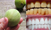 1 quả chanh, 4 cách cạo sạch CAO RĂNG, MẢNG BÁM, hàm răng luôn trắng như sứ không cần đi nha sĩ