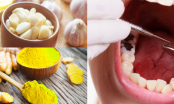7 nguyên liệu có sẵn trong nhà trị đau răng hiệu quả nhất