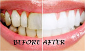 Bí quyết tẩy trắng răng nhanh và an toàn bằng nguyên liệu tự nhiên