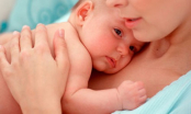 Những vấn đề về da của trẻ sơ sinh,mẹ nên nắm rõ