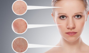 Cảnh giác với loạt bệnh về da thường gặp trong mùa hè