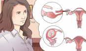 Những dấu hiệu mang thai ngoài tử cung phụ nữ nên biết