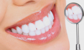 Răng  vàng ố bao nhiêu cũng trở nên trắng như sứ sau vài phút nhờ 4 cách này