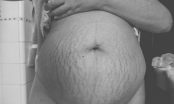 Những bức ảnh nổi da gà về sự hi sinh của phụ nữ khi mang thai
