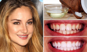 5 cách loại bỏ cao răng, giúp hàm răng trắng như sứ chỉ mất 5 phút tại nhà