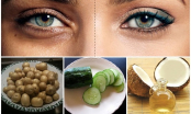 5 cách đơn giản để loại bỏ quầng thâm, bọng mắt hiệu quả nhất