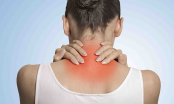 Đẩy lùi cơn đau cổ tức thì với 5 động tác cực đơn giản cho dân văn phòng