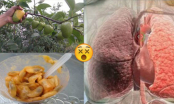 Thực phẩm chữa được bệnh lao phổi rất hiệu nghiệm, Việt Nam có đầy nhưng lại bị bỏ quên