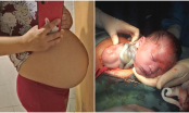 Rất nhiều mẹ bầu phạm lỗi nhỏ này khiến thai nhi còi cọc, thiếu cân khi chào đời và nuôi rất khó