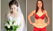 Cô dâu trẻ muốn mặc vừa váy cưới yêu thích đã giảm 7,5kg trong 1 tuần và kết quả ai cũng phải giật mình