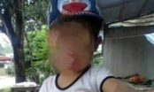 Bé trai 5 tuổi tử vong bất thường sau khi nhập viện cắt Amidan, gia đình bức xúc