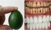 5 mẹo đánh bay cao răng chỉ sau 3 phút, giúp bạn lấy lại được hàm răng trắng sáng