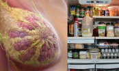 Thủ phạm hàng đầu gây ung thư vú có trong tủ lạnh của mọi gia đình