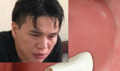 Ấn định ngày xét xử ca sĩ Châu Việt Cường sau vụ nhét tỏi vào miệng cô gái dẫn tới tử vong
