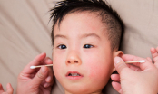 Bé trai 3 tuổi đột nhiên mất dần thính lực, đi khám mới phát hiện ra thứ bố mẹ nào cũng dùng cho con