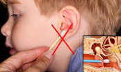 Cảnh báo: Quái vật trong lỗ tai khiến bé không nghe, chậm nói, bố mẹ cần diệt ngay kẻo trễ