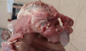 Nghi nhiễm sán lợn, 400 trẻ mầm non ở Bắc Ninh được đi xét nghiệm: Ăn thịt nhiễm sán nguy hiểm thế nào?