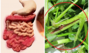 Bác sĩ cảnh báo: Đây chính là 5 loại rau chứa đầy ấu trùng sán bạn tuyệt đối không đưa vào bữa ăn
