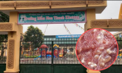 Từ vụ 209 trẻ Bắc Ninh nhiễm sán lợn: Cảnh báo 5 điều các bà nội trợ nên biết khi mua thịt lợn