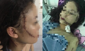 Hãi hùng cô gái 18 tuổi bị nhóm người dùng dao lam rạch mặt, cứa cổ dã man trong đêm