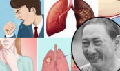 Nghệ sĩ Lê Bình qua đời vì ung thư phổi: Bác sĩ chỉ ra thủ phạm gây bệnh vô cùng quen mặt