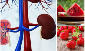 5 loại trái cây mà thận ''yêu thích'': Ăn một quả- thận khoẻ cả năm, loại bỏ tất cả tạp chất khỏi cơ thể