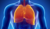 Lọc phổi sạch bong nhờ 5 món ăn bình dân nhưng mạnh như máy hút bụi, thải mọi độc tố ra khỏi cơ thể