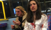 Cặp đôi đồng tính bị nhóm người đánh đập tới tấp trên xe buýt nhưng lý do mới khiến mọi người choáng váng