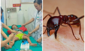 Bé 3 tuổi nguy kịch vì kiến cắn: BS mách mẹ cách xử lý vết thương do côn trùng
