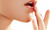 5 bí kíp chị em nên biết khi môi bị thâm hoặc bong tróc