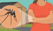Ăn gì để muỗi tránh xa, không còn lo bị sốt xuất huyết?
