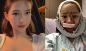 Lưu Đê Ly bất ngờ công khai quá trình phẫu thuật thẩm mỹ toàn bộ gương mặt