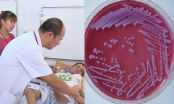 Nhiều người nhập viện vì nhiễm vi khuẩn ăn thịt người: Bệnh này có điều trị được không?