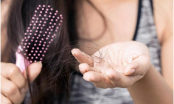 Bỏ túi mẹo nhỏ giúp tóc không bị rụng trong thời tiết giao mùa